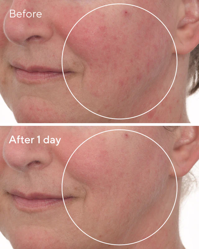 Cellular Hydration Barrier Repair Mask - Image 4