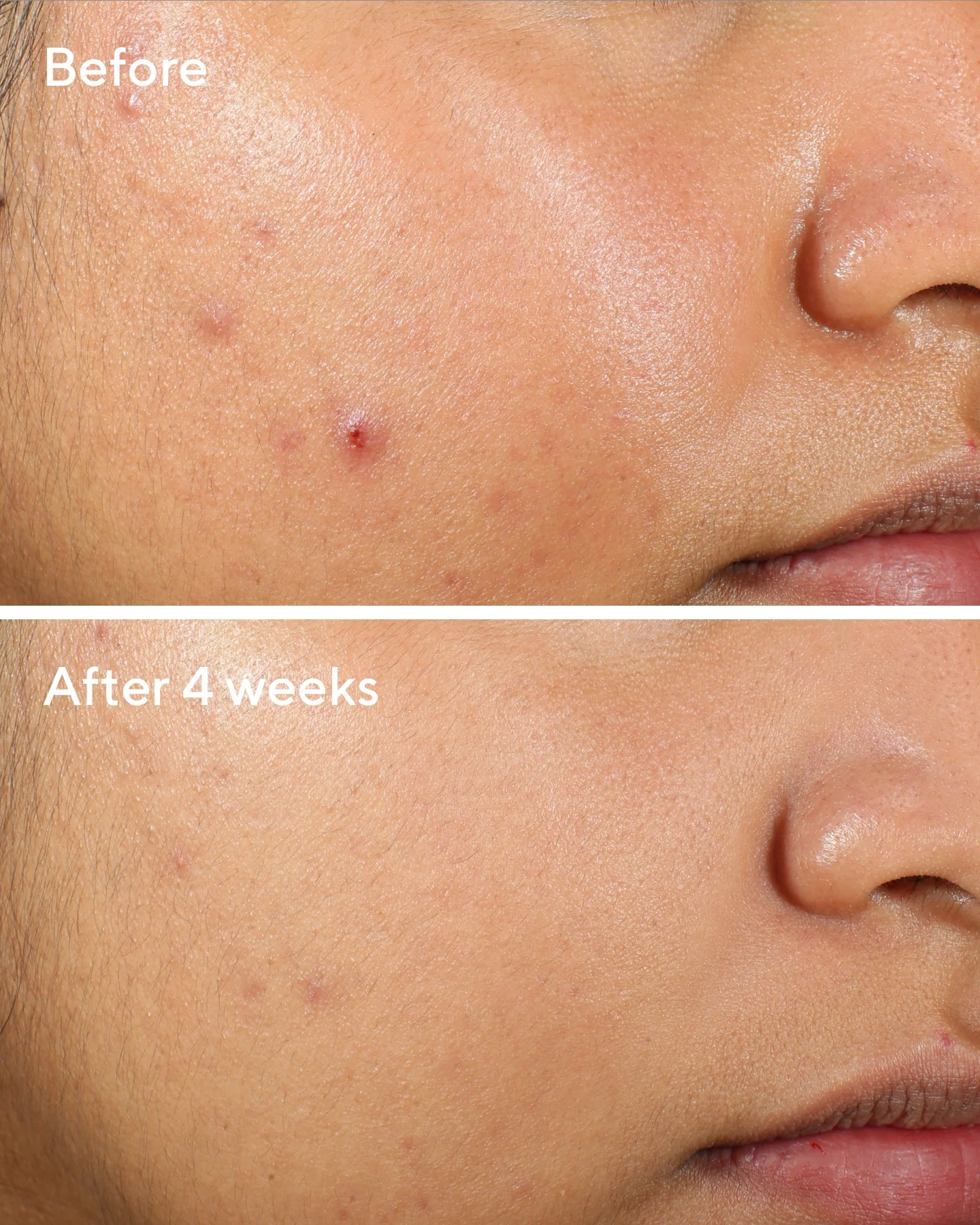 Clarifying Water Gel - Image 5