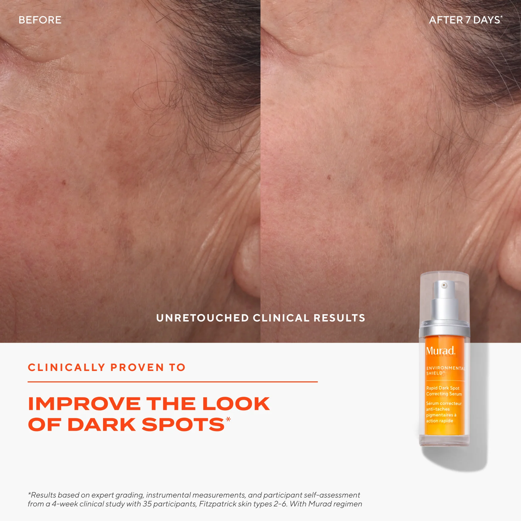 Dark Spot Clearing Duo - Image 4