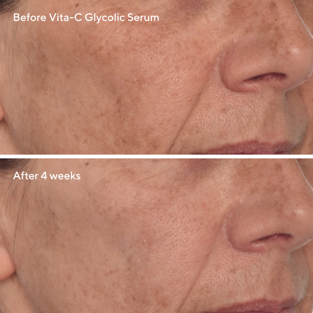 Radiant Skin Discovery Kit - Image 5