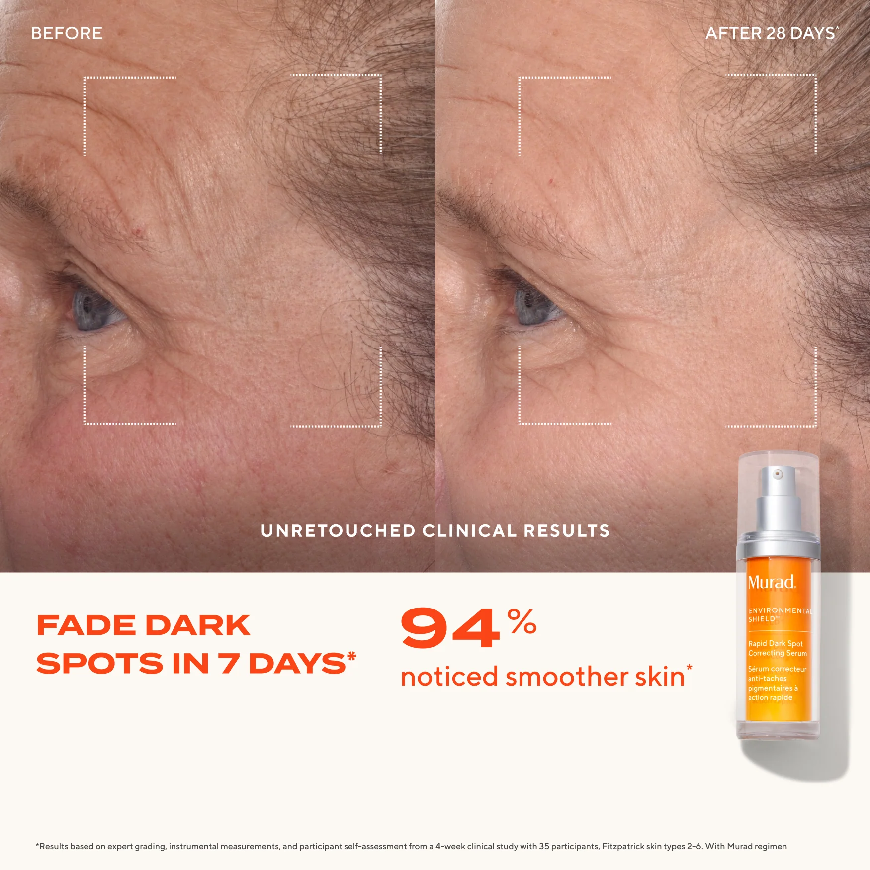 Rapid Dark Spot Correcting Serum - Image 5