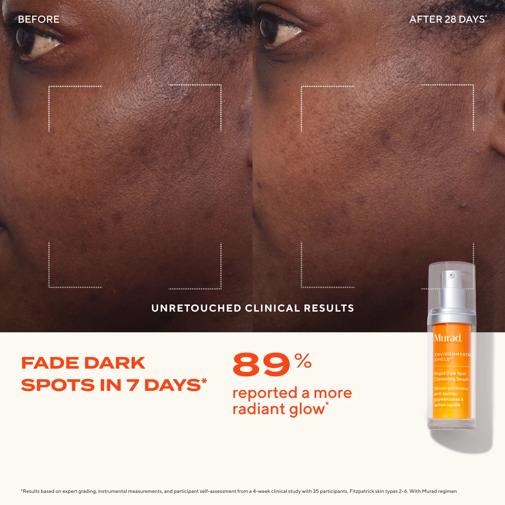 Rapid Dark Spot Correcting Serum - Image 6