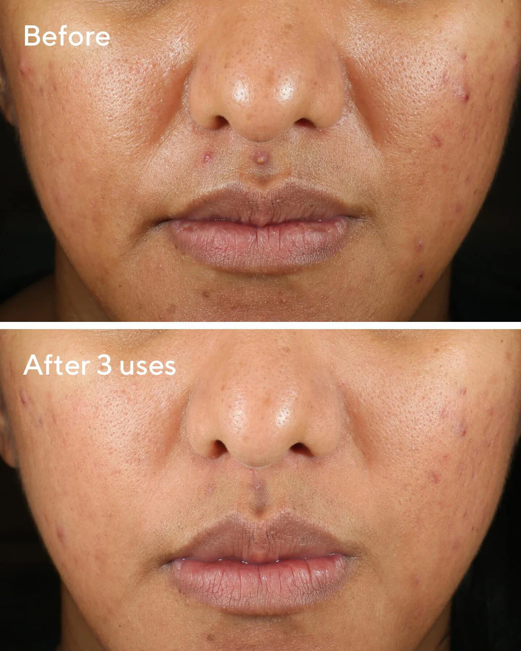 Rapid Relief Sulfur Mask - Image 5