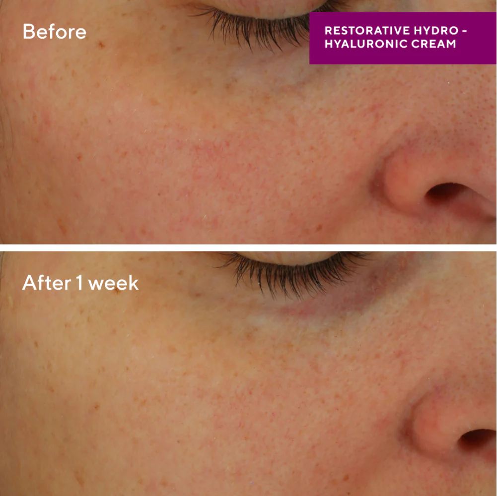 Restorative Hydro-Hyaluronic Cream - Image 3