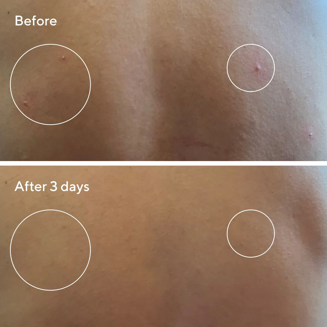Retexturising Body + Face Pads - Image 5