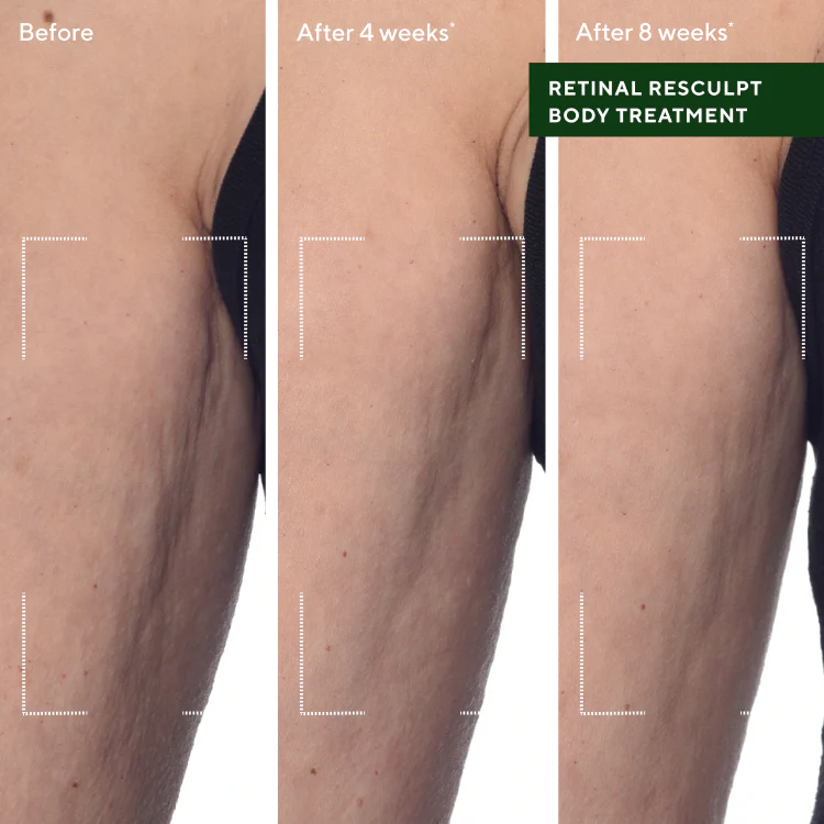 Retinal ReSculpt Body Treatment - Image 7