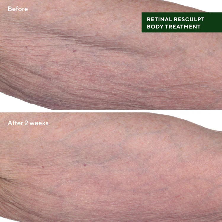 Retinal ReSculpt Body Treatment - Image 9