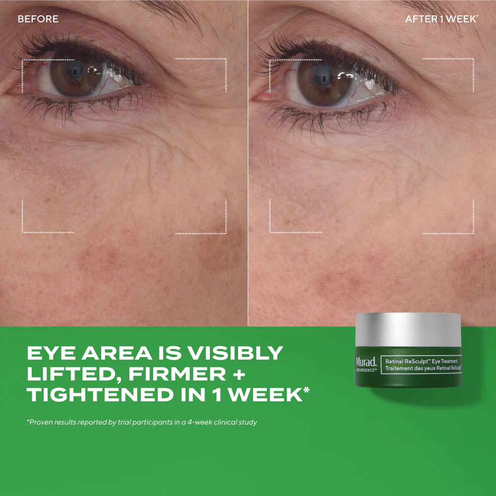 Retinal ReSculpt™ Eye Treatment - Image 4