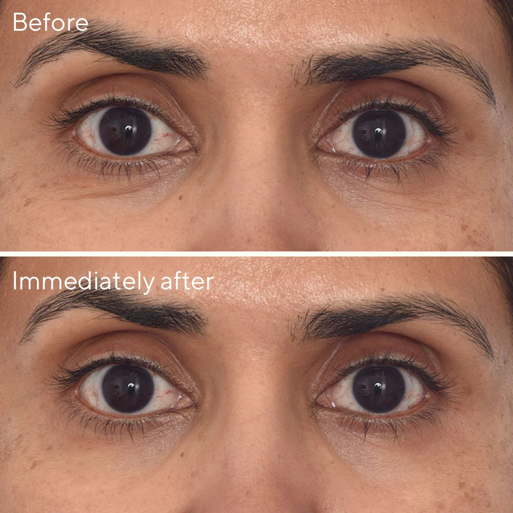 Retinol Youth Renewal Eye Masks - Image 5