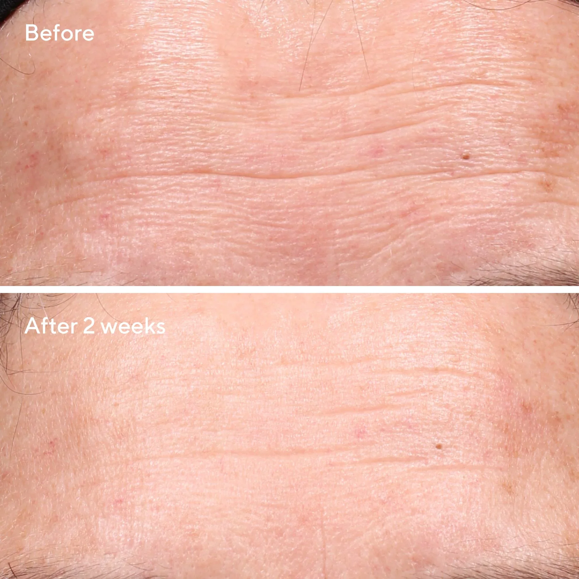 Retinol Youth Renewal Serum - Image 4