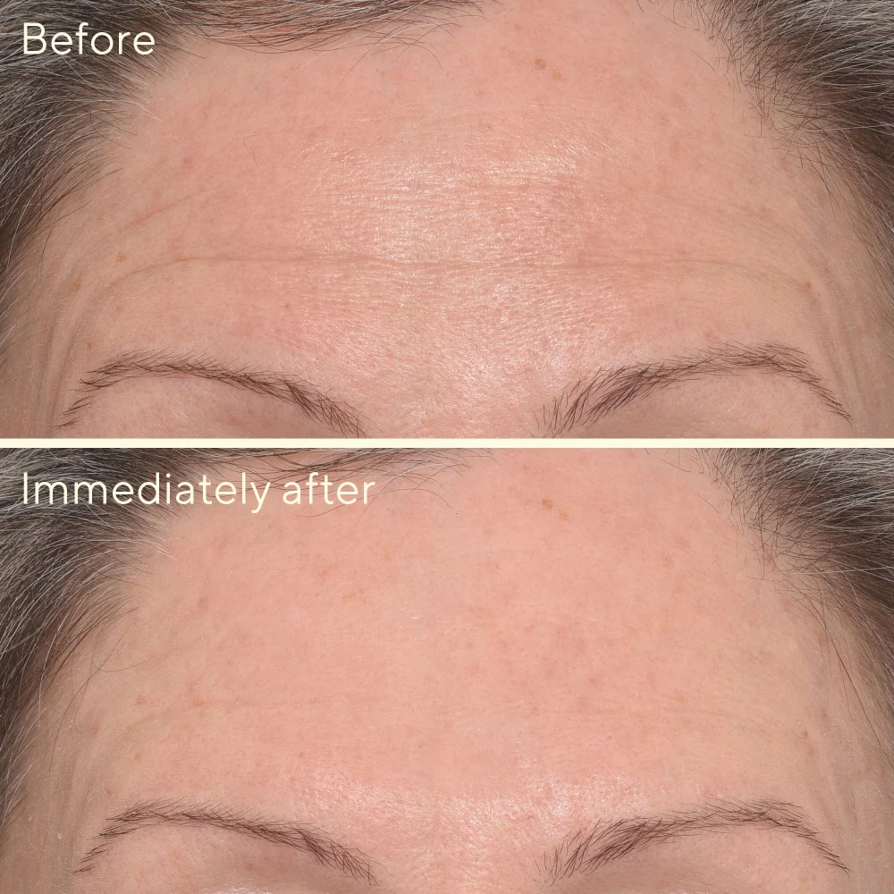 Targeted Wrinkle Corrector - Image 5